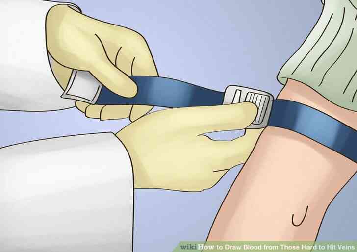 Image intitulée prélever du Sang de Ceux Difficile de Frapper les Veines de l